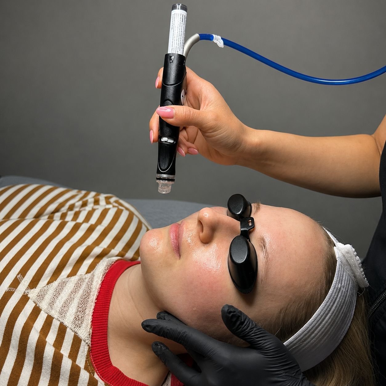 HydraFacial treatment wand during a facial at Bella Noor Skincare